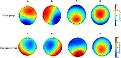 EEG microstates are associated with music training experience